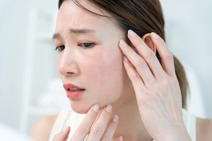 室内でもシミが増える？紫外線の落とし穴とは？